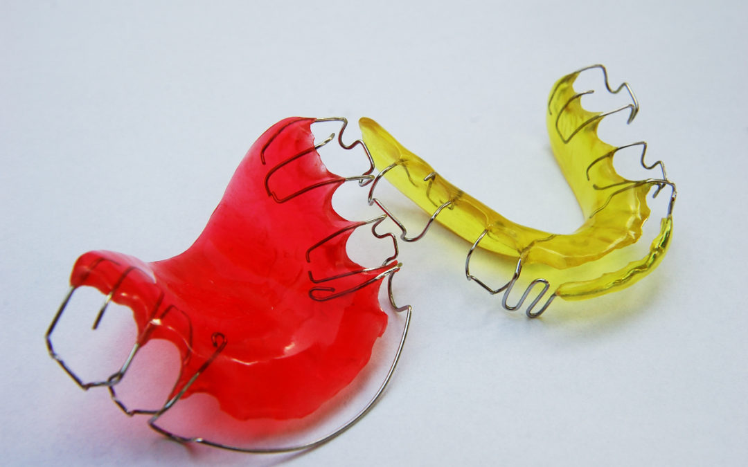 Los retenedores son imprescindibles tras un tratamiento de ortodoncia