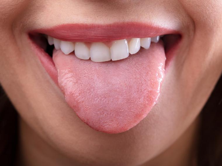 ¿Por qué debemos limpiar correctamente la lengua?