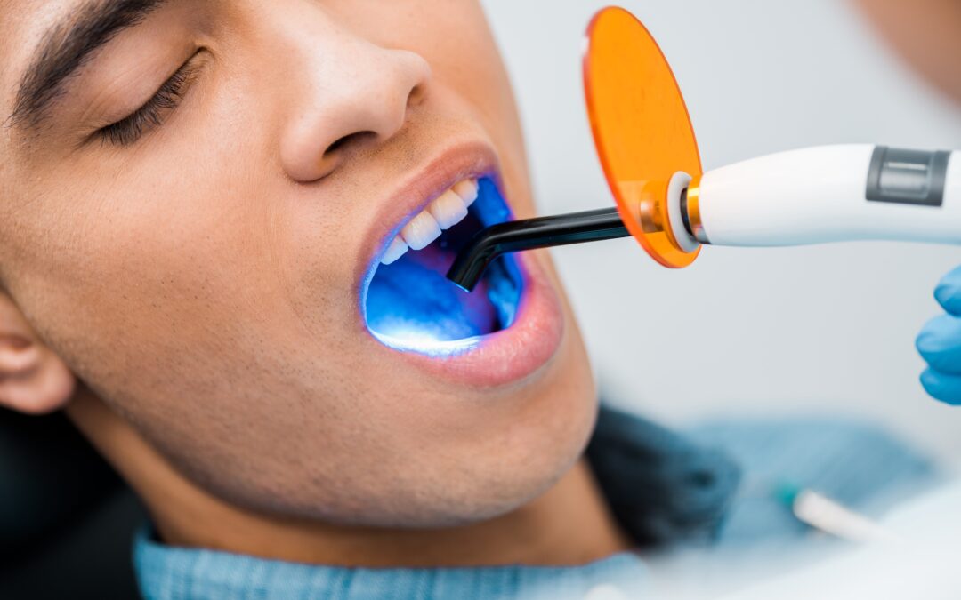 Descubre cómo elegir el blanqueamiento dental ideal