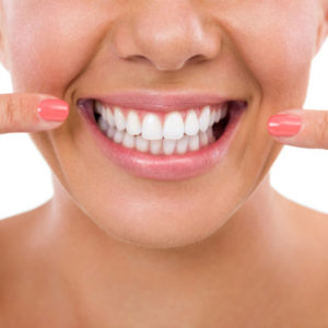 blanqueamientos dentales