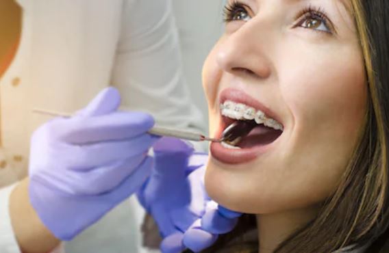 ¿Necesitas ortodoncia? conoce las ventajas y desventajas de cada tipo