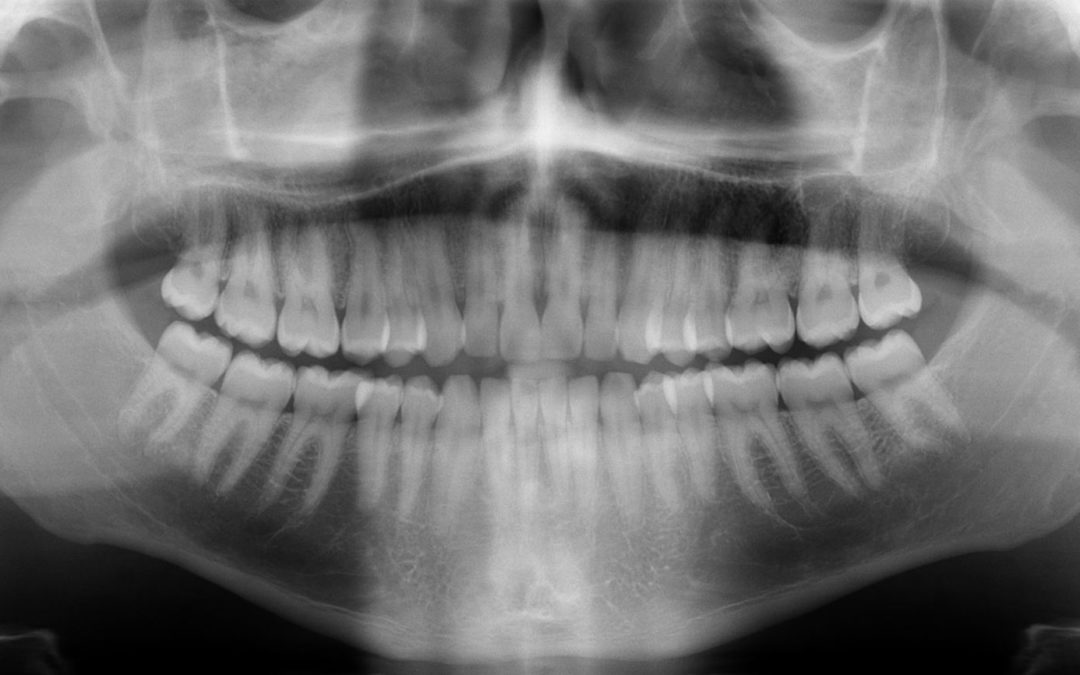 Radiografías: El mejor método para conseguir un diagnóstico preciso