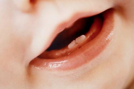 ¿Por qué hay niños que nacen con un diente?
