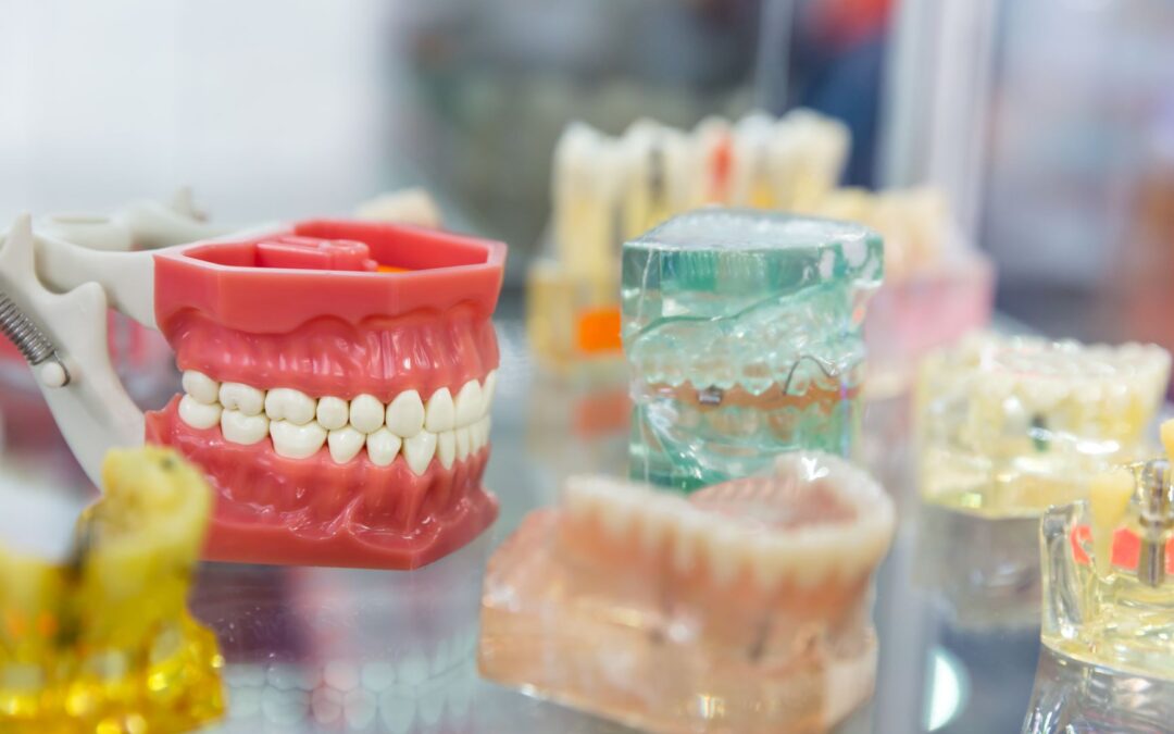 Consejos para mantener intacta tu dentadura postiza
