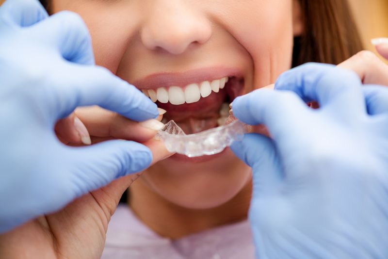 Esta es la forma de limpiar correctamente tu Invisalign