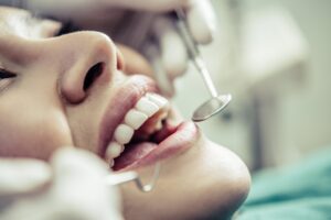 curar-bultos-paladar-dentista