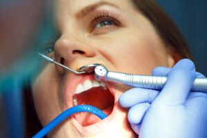 anemia-salud-dental