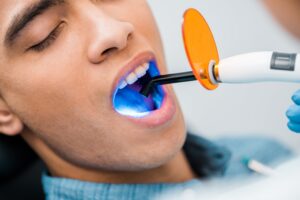 blanqueamiento-dental-carolina-lopez