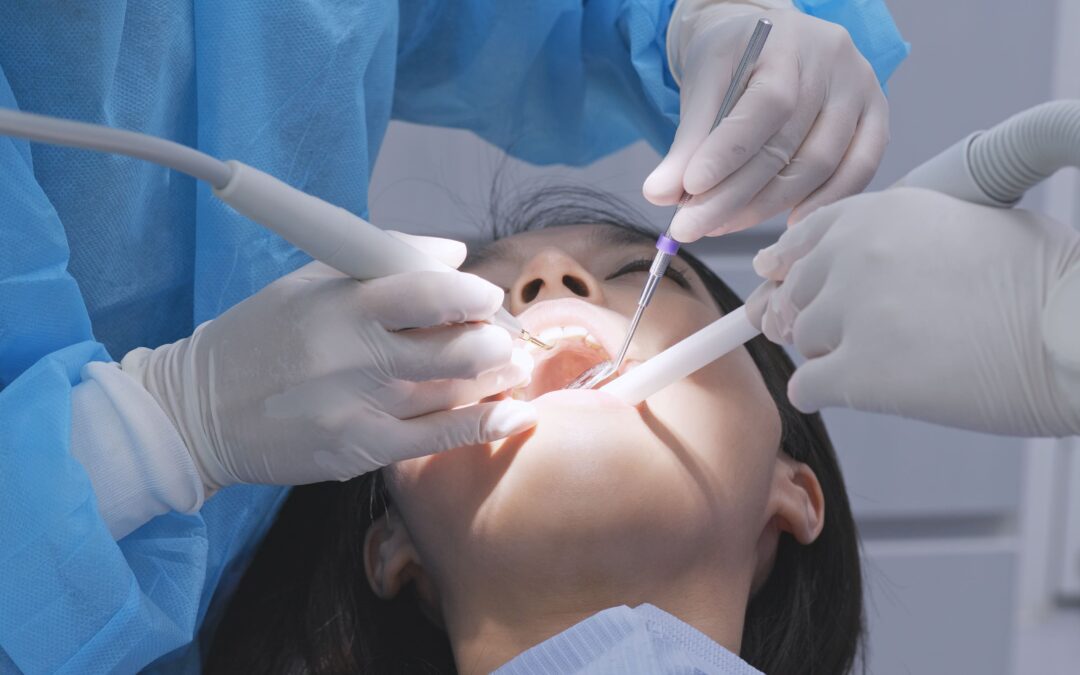 Higiene dental: cuántas limpiezas dentales necesito