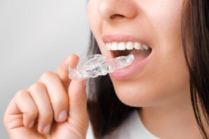 ataches-invisalign-clinica-carolina-lopez