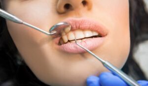 troneras-periodontitis-dentista-valencia