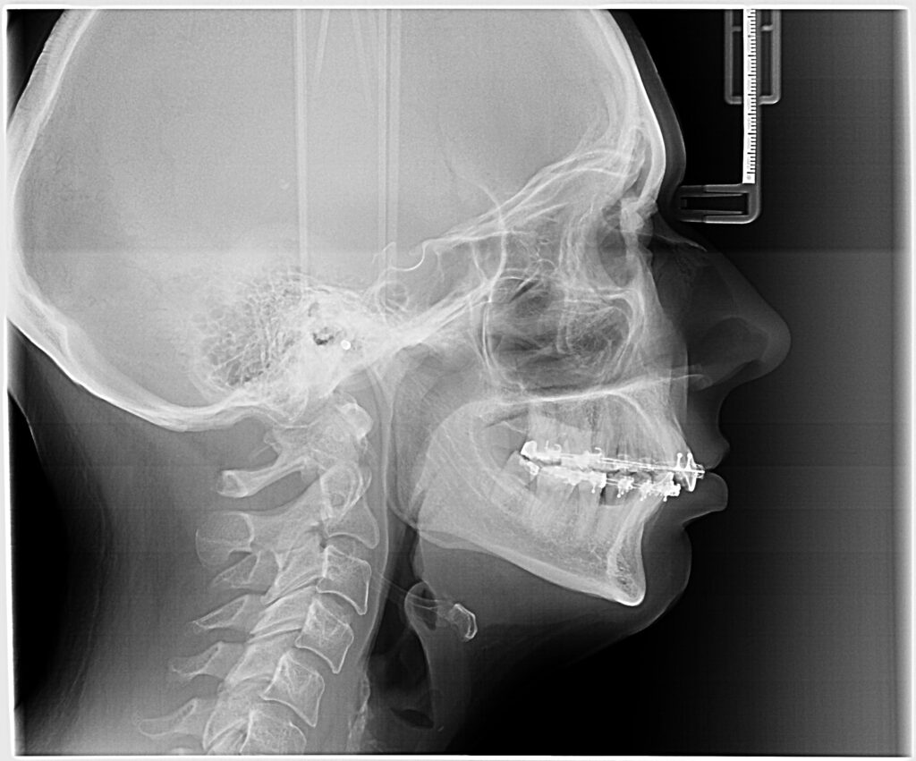 estudio-ortodoncia-radiografia-valencia