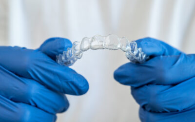 Invisalign: todos los complementos que debes conocer con tu ortodoncia invisible