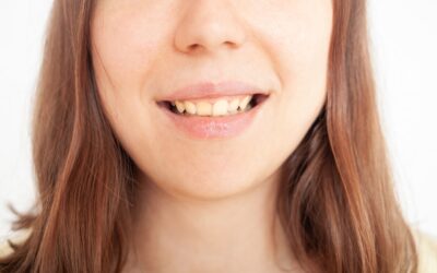 Sonrisa gingival: tipos de sonrisa y cómo corregirlo