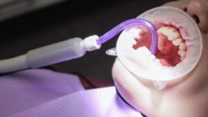 sindrome-sjogren-soluciones-dentista