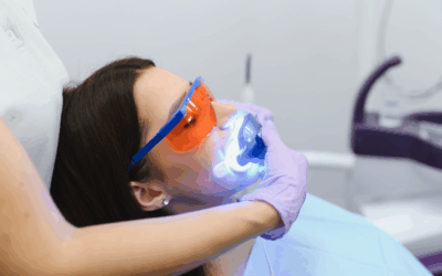 Alineadores y estética dental: cuándo realizar un blanqueamiento